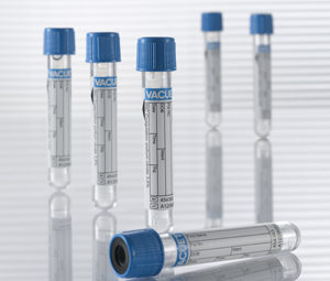 blue top citrate tubes